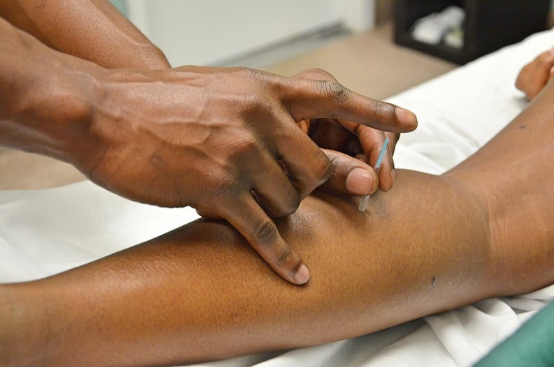 Acupuncture Needles
